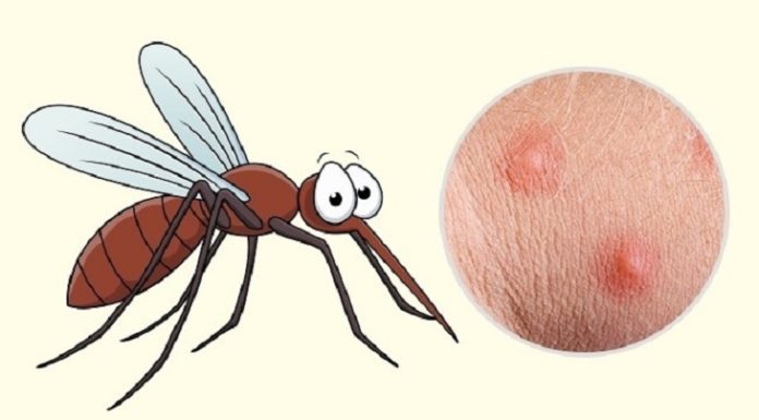 “What Causes Mosquitoes to Bite You More than Others?”