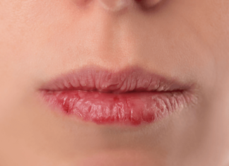 Experience Softer, More Supple Lips with At-Home Treatments