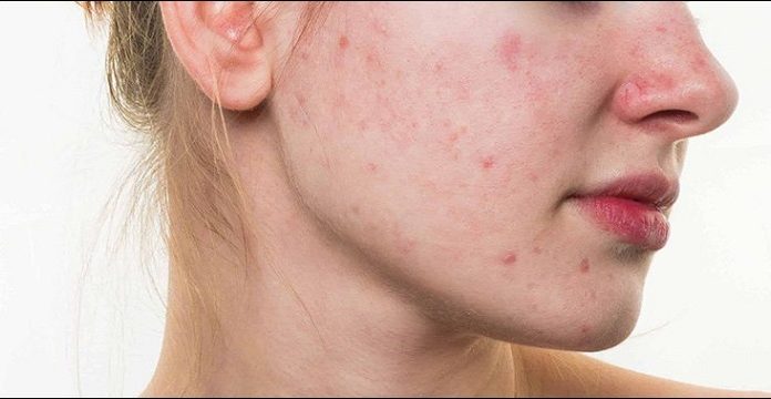 Simple Tips to Clean Makeup Brushes at Home