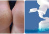 Using Toothpaste: A Guide to Effectively Treat Cracked Heels