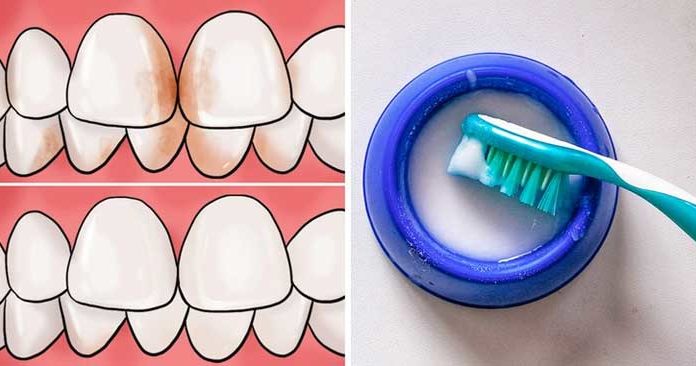 5 Super Easy Ways to Get Whiter Teeth at Home Without Spending a Penny