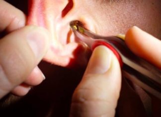 3 Alarming Health Warning Signs – Visit a Doctor Immediately