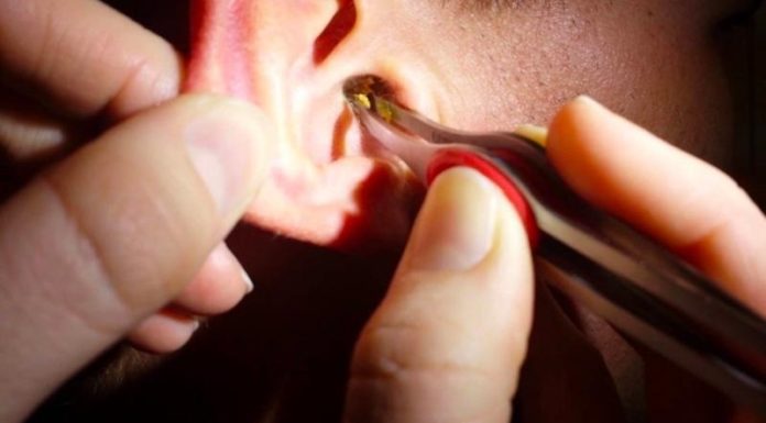 3 Alarming Health Warning Signs – Visit a Doctor Immediately