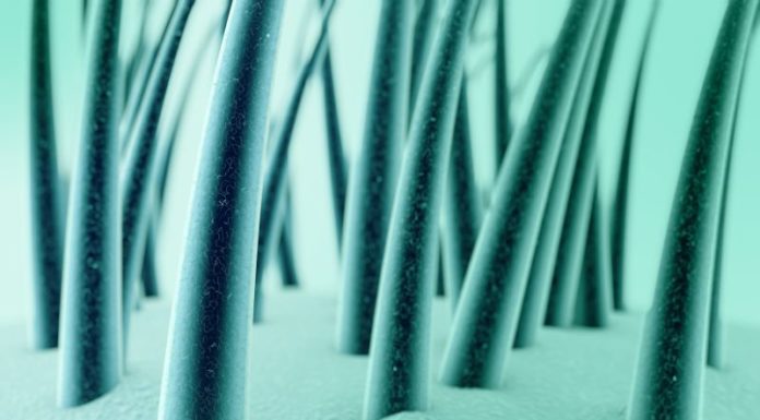 “Dandruff Be Gone! How to Use Pink Salt Shampoo”