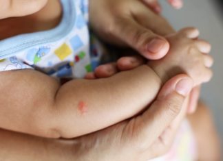 Simple but Extremely Effective Tips to Keep Mosquitoes Away from Your Baby