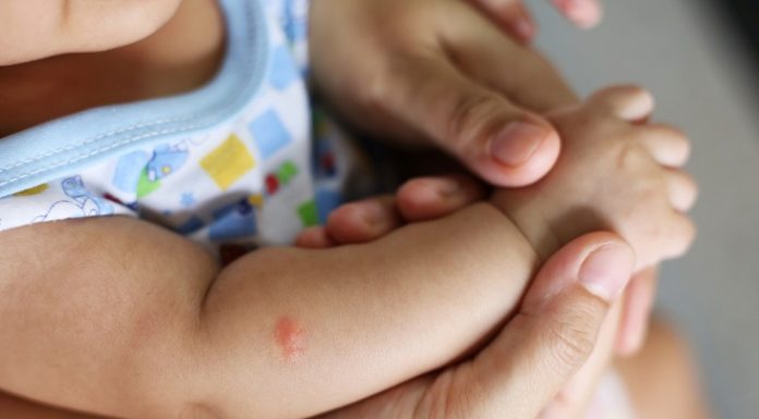 Simple but Extremely Effective Tips to Keep Mosquitoes Away from Your Baby