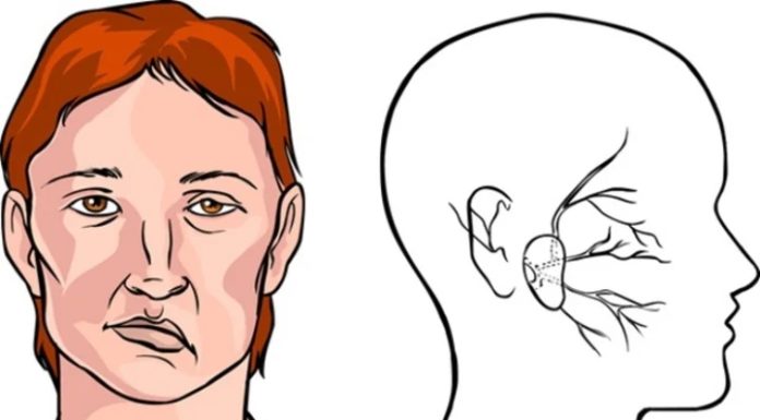 How to deal with being caught in a wind storm