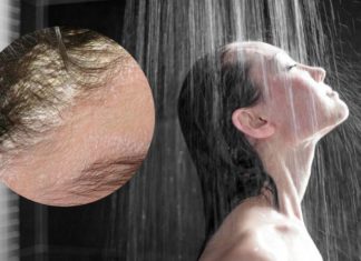 Investigating the Relationship Between Bedtime Showers and Dandruff Occurrence