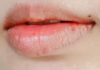 How to Achieve Optimal Plumpness and Perfection with Your Lips