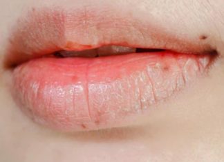 How to Achieve Optimal Plumpness and Perfection with Your Lips