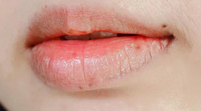 How to Achieve Optimal Plumpness and Perfection with Your Lips