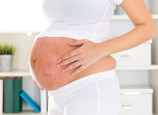 Pregnancy Acne: Essential Principles for Moms-to-be to Remember in Treating Acne