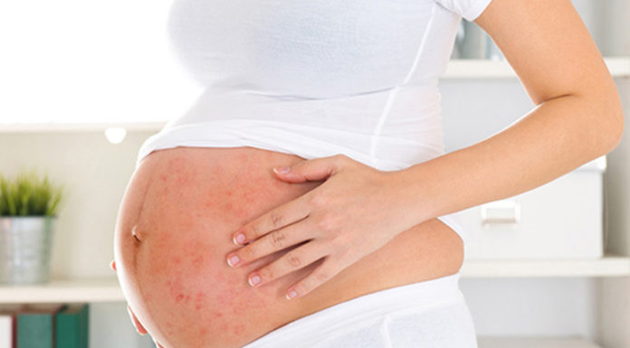 Pregnancy Acne: Essential Principles for Moms-to-be to Remember in Treating Acne