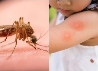 Tips to Reduce Itching from Mosquito Bites