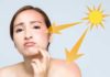The Sunburn Conundrum: Unveiling the Culprits Behind Skin Discomfort and 4 Potent Remedies for Calming the Irritation