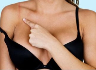 Alert: Be Aware of the Risks of Wearing an Unsuitable Bra