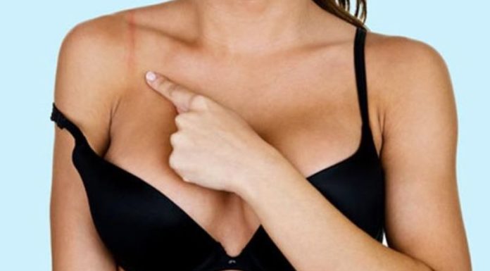 Alert: Be Aware of the Risks of Wearing an Unsuitable Bra