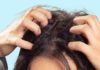 Dangers of Poor Hygiene on the Scalp that Lead to Unpleasant Smells