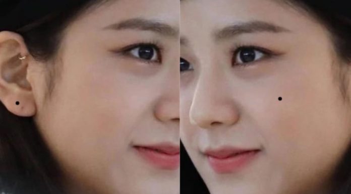 The Ancient Wisdom: If you have these 3 moles, you’ll be wealthy and able to spend money freely. Even having 1 mole is a cause for celebration.