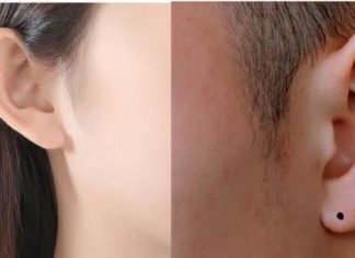 Rare Mole is a Lucky Charm for Wealth and Prosperity throughout Life