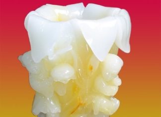 6 Feng Shui Items for Love and Good Luck – Bringing Abundance and Fortune