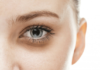 6 Simple Tips to Get Rid of Dark Circles During Busy Days Before Tet
