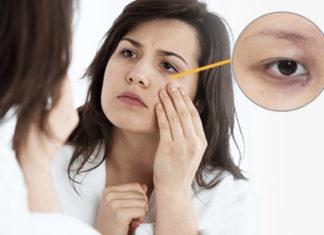 5 Ways to Banish Under Eye Circles and Restore Youthful Skin