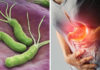 4 Signs That Your Body Has H. pylori Bacteria, Eat These 5 Foods That H. pylori ‘Fear’ to Protect Your Stomach