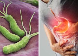 4 Signs That Your Body Has H. pylori Bacteria, Eat These 5 Foods That H. pylori ‘Fear’ to Protect Your Stomach