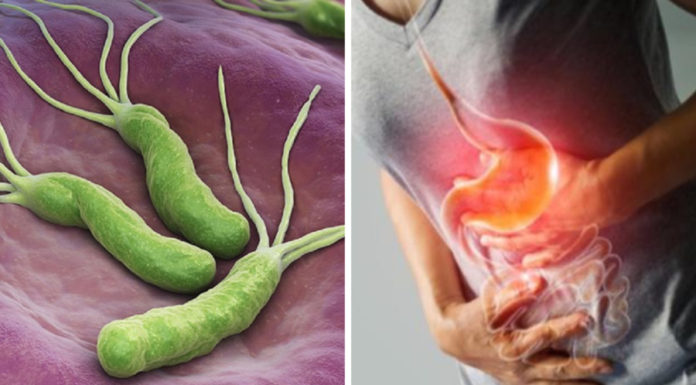 4 Signs That Your Body Has H. pylori Bacteria, Eat These 5 Foods That H. pylori ‘Fear’ to Protect Your Stomach