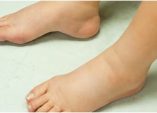 5 Warning Signs Your Kidney is Desperately Crying for Help: 1 in 5 Should Seek Immediate Medical Attention