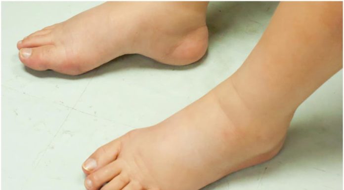 5 Warning Signs Your Kidney is Desperately Crying for Help: 1 in 5 Should Seek Immediate Medical Attention