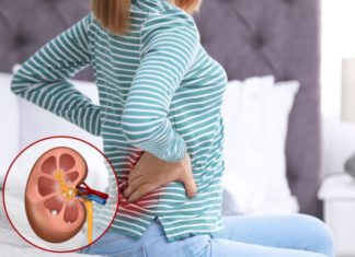 9 Body Places You Never Knew Could Develop Painful Stones