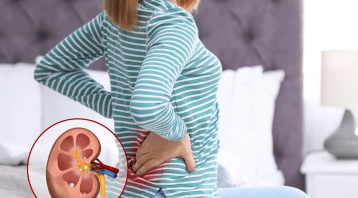 9 Body Places You Never Knew Could Develop Painful Stones