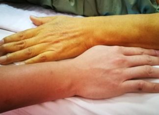 People with strong guts won’t have these 3 hand signs: Check if you don’t