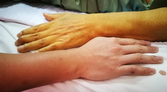 People with strong guts won’t have these 3 hand signs: Check if you don’t