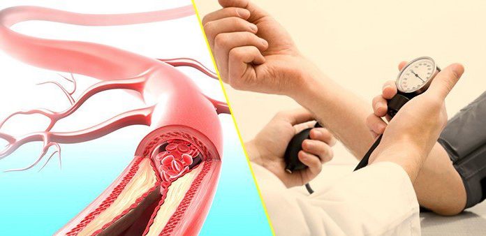 Simple Home Remedies to Lower High Blood Pressure Quickly and Reduce Dependence on Medication