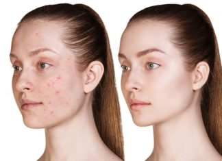 Trending Beauty Trends Taking Over the Market in 2024: A Favorite Among Women