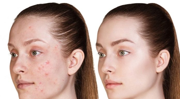 Trending Beauty Trends Taking Over the Market in 2024: A Favorite Among Women