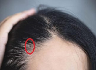 Moles Are More Valuable Than Gold, Whoever Has Them is Endlessly Fortunate, Wealth Knows No Bounds