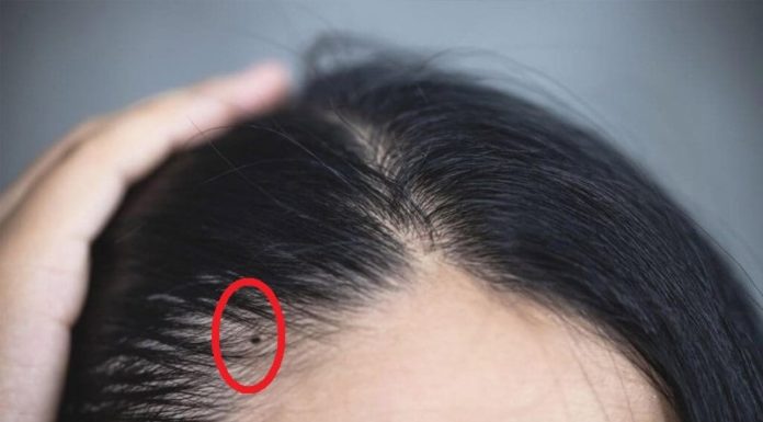 Moles Are More Valuable Than Gold, Whoever Has Them is Endlessly Fortunate, Wealth Knows No Bounds