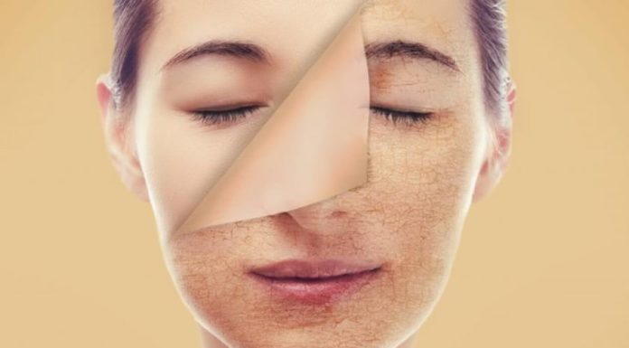 Quickly fix discolored skin with this simple method