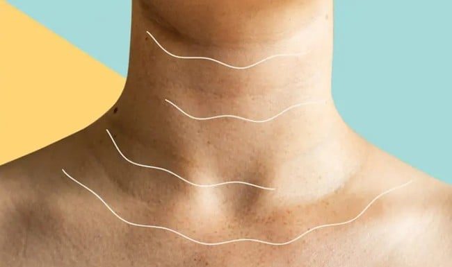 4 Reasons for Sagging and Wrinkled Neck Skin and Simple Remedies