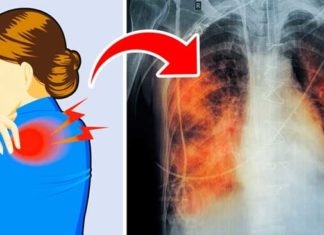 5 Signs of Lung Disease. Do You Have Any Symptoms?