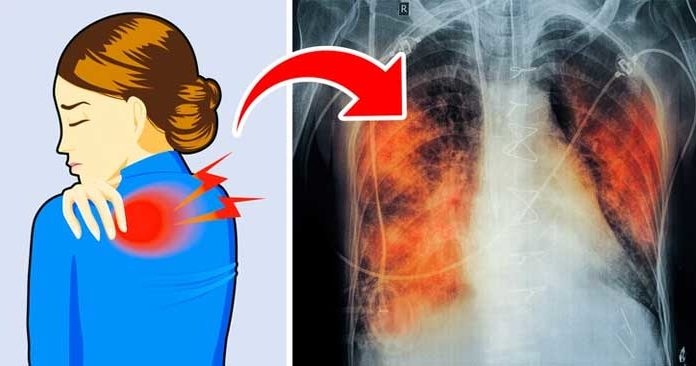 5 Signs of Lung Disease. Do You Have Any Symptoms?