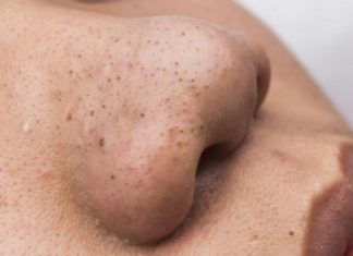 3 Warning Signs on Your Face That Shouldn’t Be Ignored