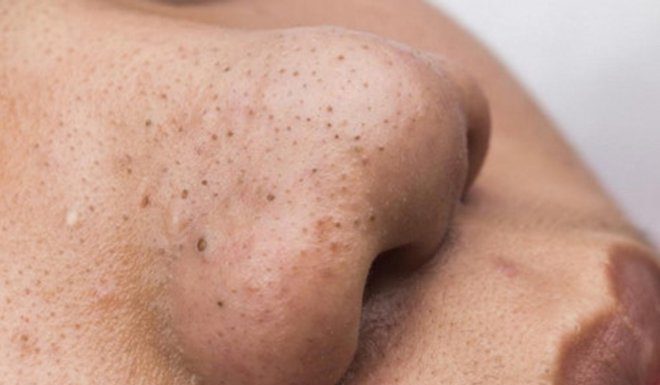 3 Warning Signs on Your Face That Shouldn’t Be Ignored