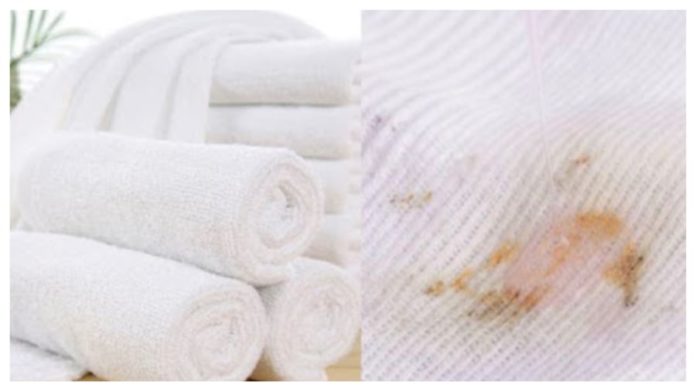 Face towels with yellow stains and pus, don’t throw them away: Try this method to make them clean and fresh like new.