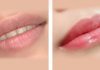 What is the essence of lip lightening? How is lip lightening different from lip tattooing?