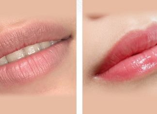 What is the essence of lip lightening? How is lip lightening different from lip tattooing?